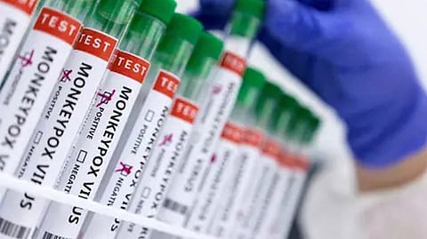 Monkeypox threat: DPH’s fresh guidelines to airport officials