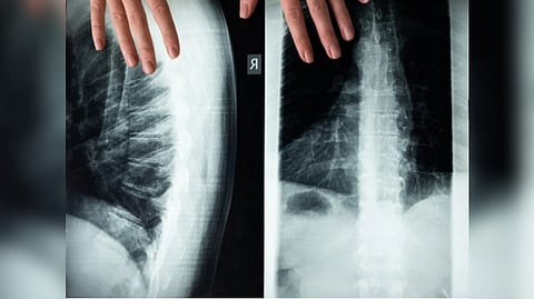 Representative image