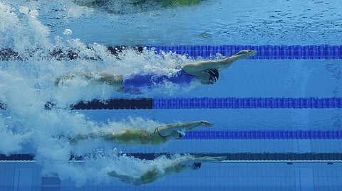 Representative image