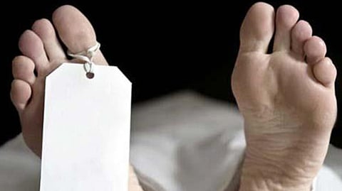 Representative image