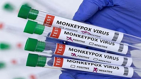 Representative Image