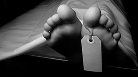 Representative image