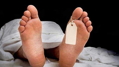 Representative image