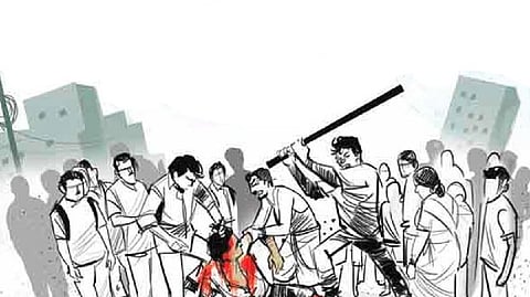 Representative image.