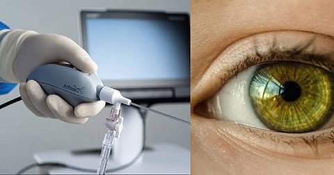 Representative image