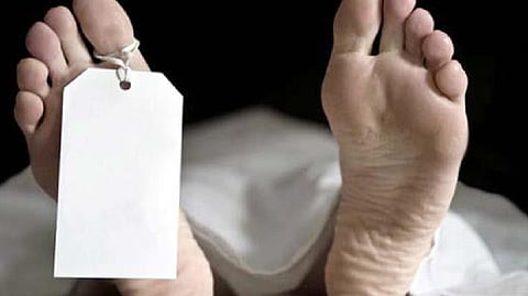 Representative image