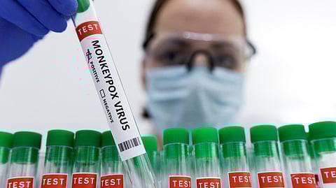 Representative image