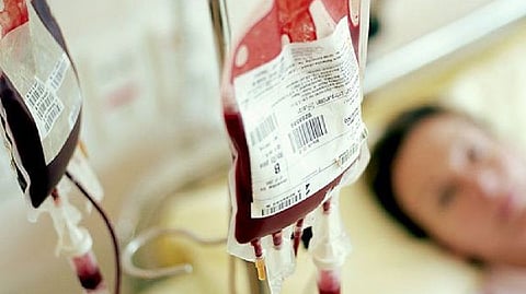 Representative image