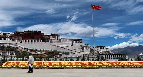 Representative Image