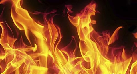 Representative Image