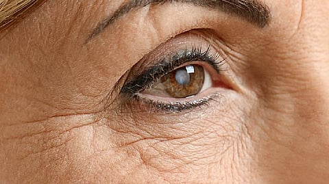 Representative image