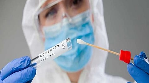 Representative image