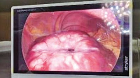 An image of the affected liver