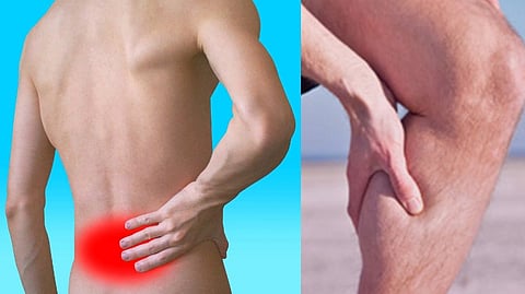 Representative image