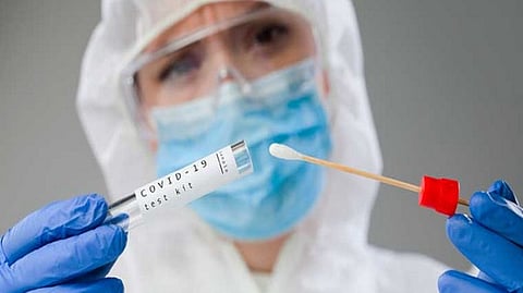 Representative image