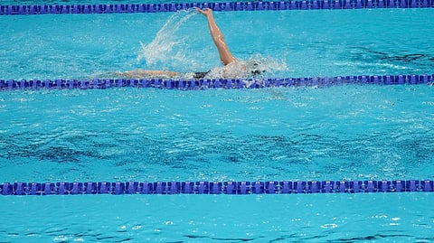 Representative image