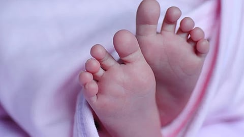 Representative Image