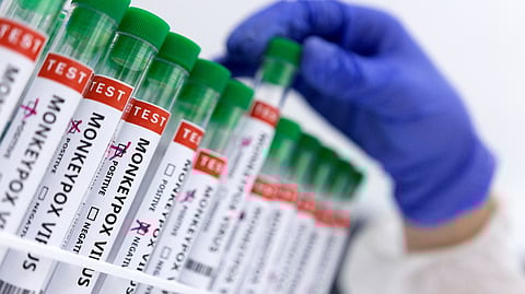 Representative image