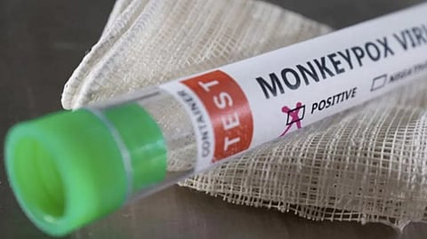 Representative image