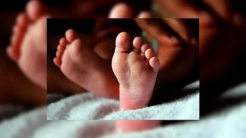 Representative image