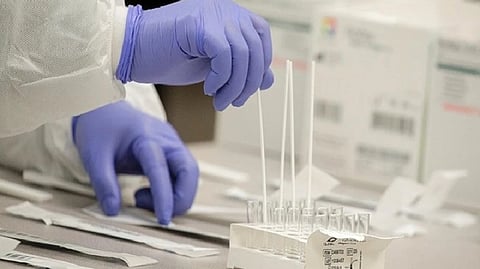 Representative image