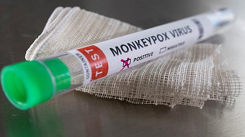 Representative Image