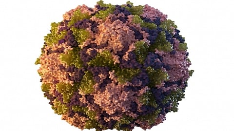 Representative image