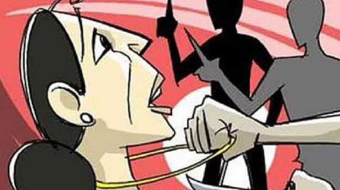 Representative image