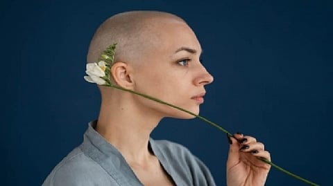 Representative image