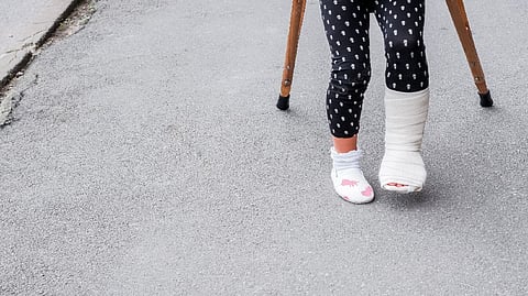 Representative Image