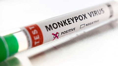 Representative image