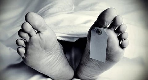 Representative Image