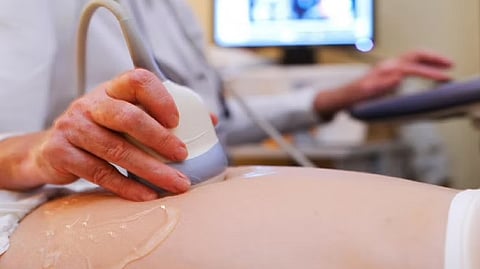 Representative image