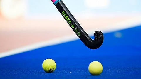 Representative image