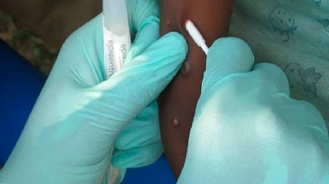 Representative image