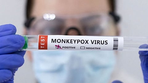 Representative image