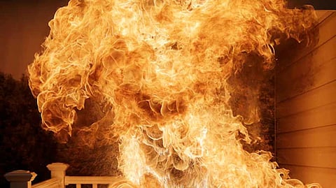 Representative image