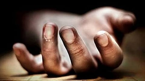 Representative image