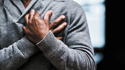 Representative image