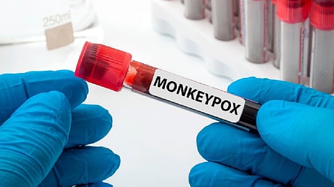 Representative Image