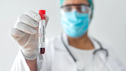 Representative Image