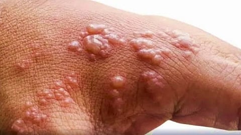 Representative Image