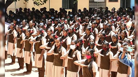 Representative image