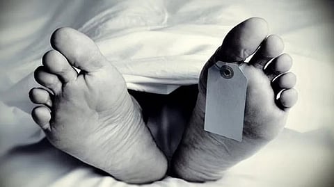 Representative image