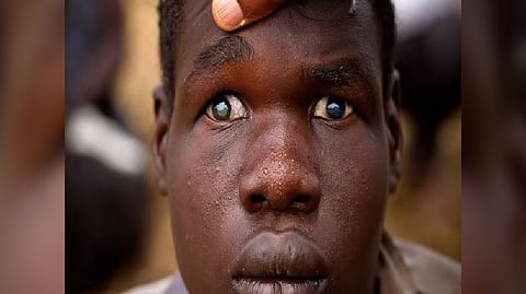 Representative Image