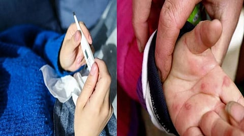 Representative image