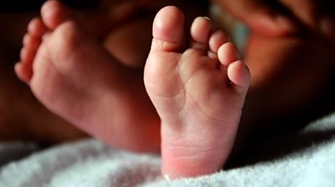 Representative image