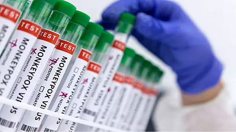 Representative image