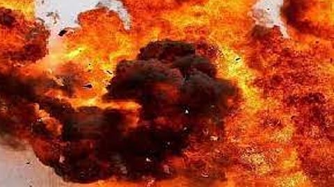 Representative image