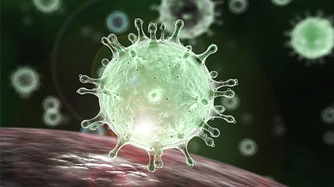 Representative image